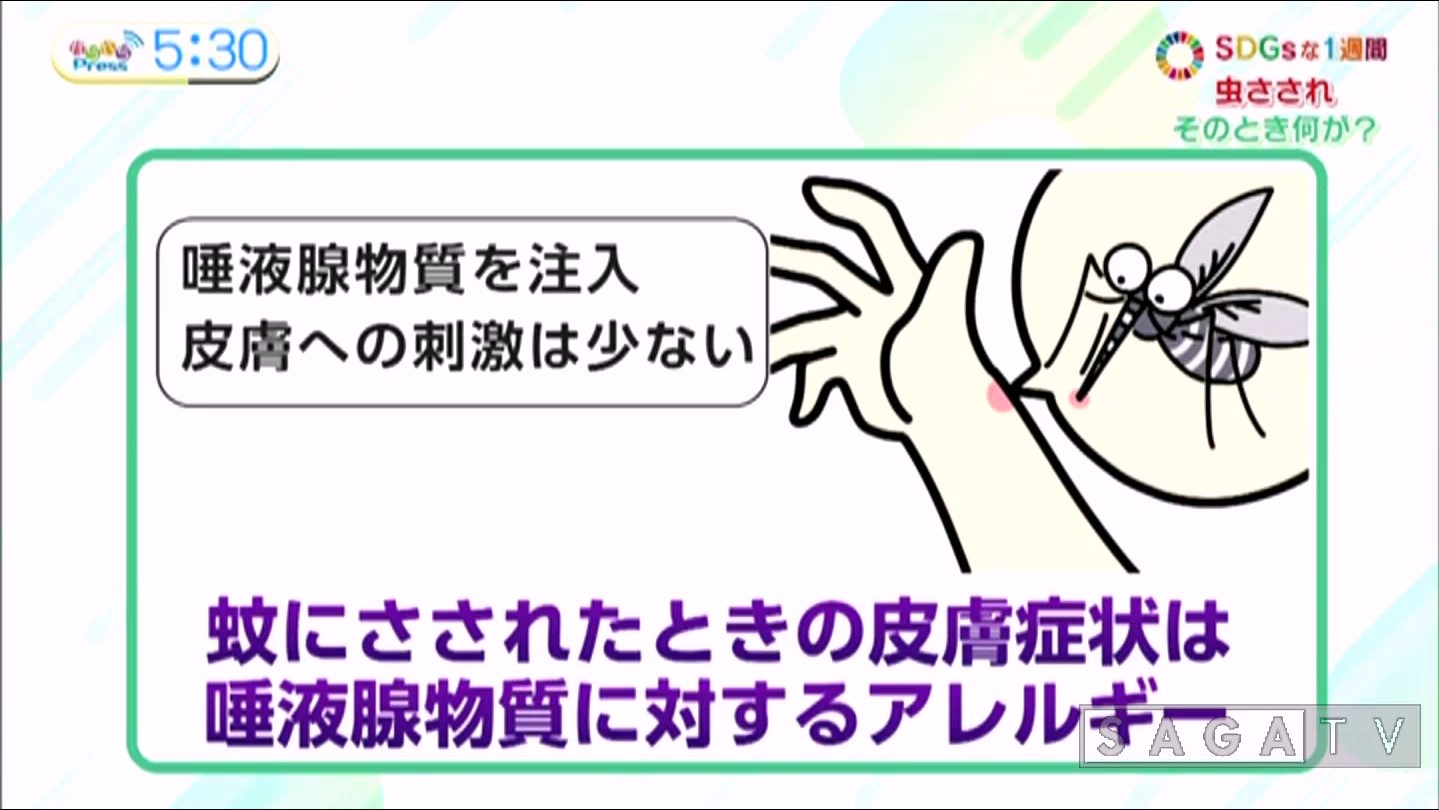 虫に刺されたときの知って得する対処法