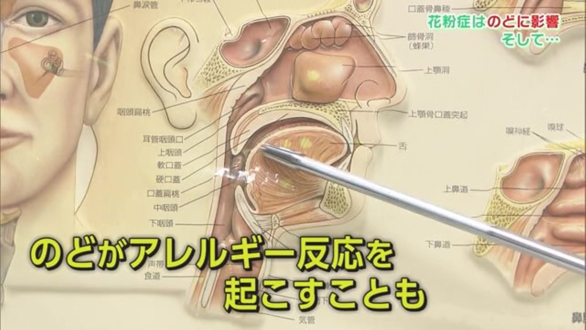 花粉症は喉にも影響 口呼吸でさらに悪化に？